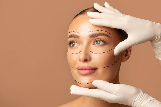 FACE LIFT (RF)